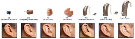 Best Hearing Aids Australia: Making the Right Choice for Your Hearing.